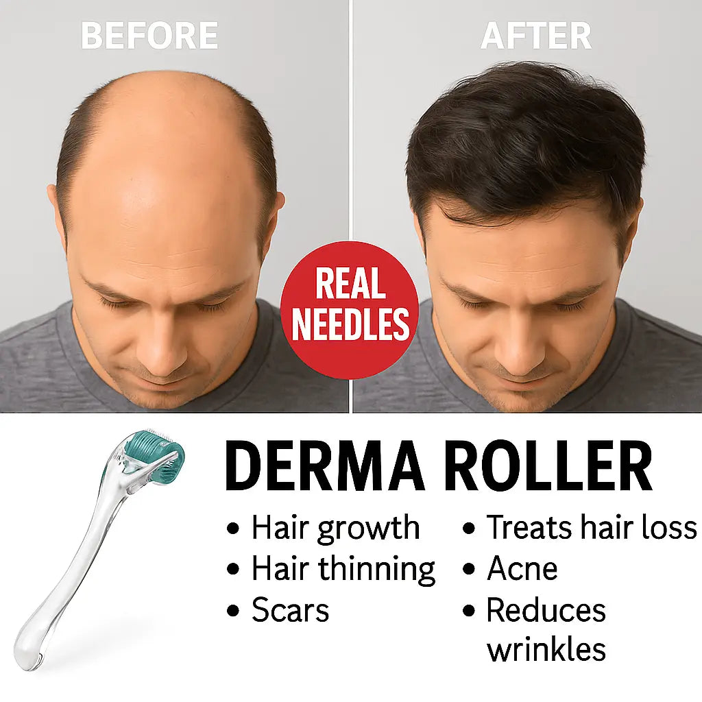 Derma Roller With Real 192 Individual Stainless Steel Microneedles — image 2 — Meeshop Pakistan